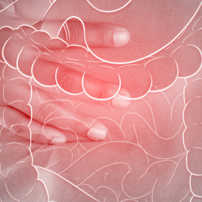 Disturbi intestinali
